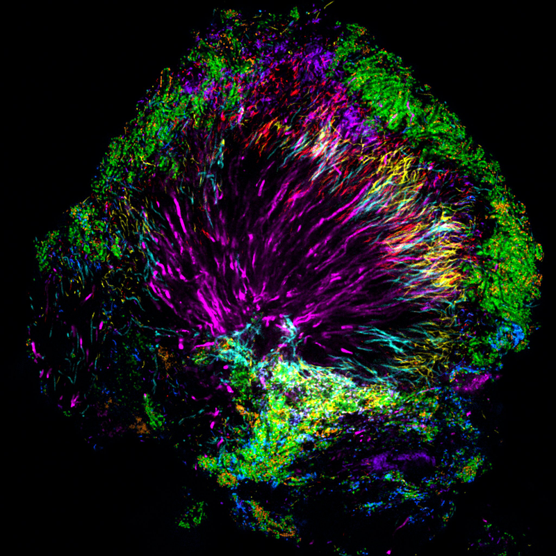 Illustration for article titled There Are Some Seriously Psychedelic Bacteria Living on Your Teeth